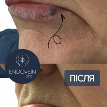 Наталія Семененко, Київ Фото - 5