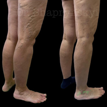 Василий Шапринський, Киев Фото - 5