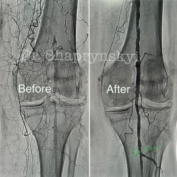 Василий Шапринський, Киев Фото - 6