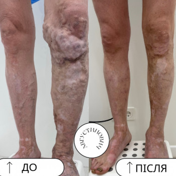 Іван Августинович, Київ Фото - 5