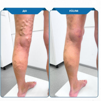 Андрей Бахтызин, Киев Фото - 5