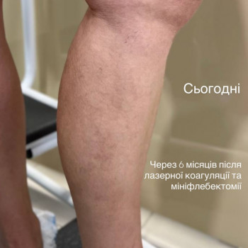 Денис Свирский, Киев Фото - 6