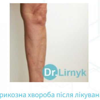 Сергей Лирник, Киев Фото - 5