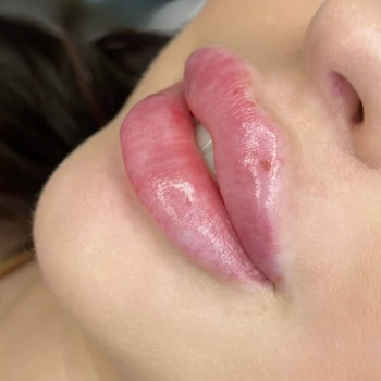 Фото из портфолио косметолога Любов Чумаченко (Запорожье)