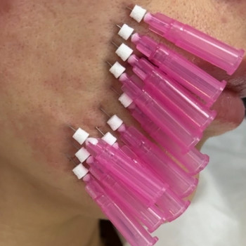 Фото из портфолио косметолога Любов Чумаченко (Запорожье)