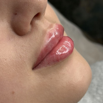 Фото из портфолио косметолога Любов Чумаченко (Запорожье)