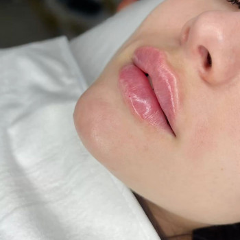 Фото из портфолио косметолога Любов Чумаченко (Запорожье)