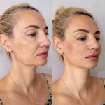 Facetem S Косметолог-ін'єкціоніст Любов Запоріжжя