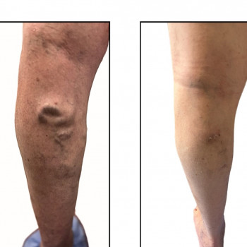 Вадим Мальченко, Київ Фото - 5