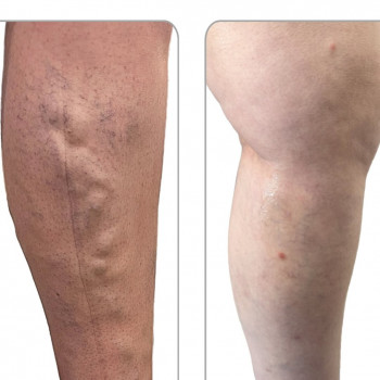 Вадим Мальченко, Київ Фото - 6