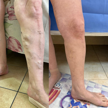 Андрей Рябоконь, Одесса Фото - 5