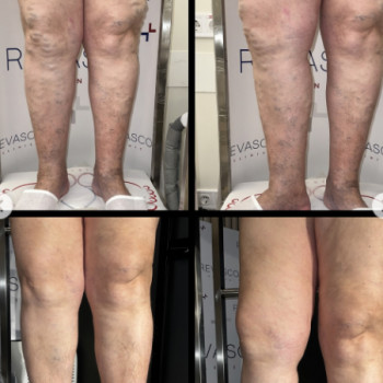 Роман Радиш, Львов Фото - 5