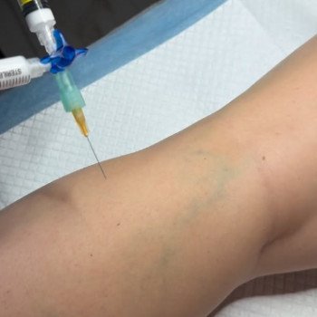 Орест Мельник, Львов Фото - 6