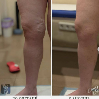 Александр Соколов, Днепр Фото - 5