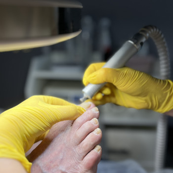 Фото з портфоліо фахівця Олена Шибанова (подолог, Черкаси)