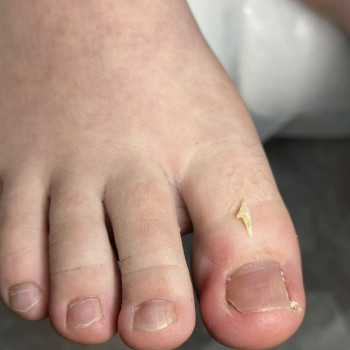 Фото з портфоліо фахівця Олена Шибанова (подолог, Черкаси)