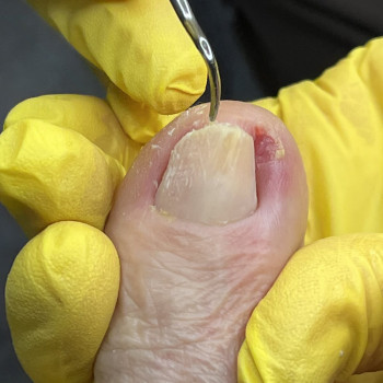 Фото з портфоліо фахівця Олена Шибанова (подолог, Черкаси)