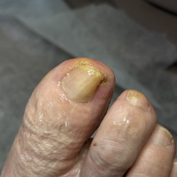 Фото з портфоліо фахівця Олена Шибанова (подолог, Черкаси)