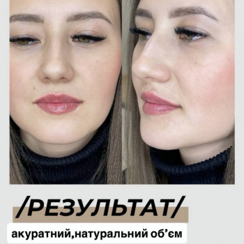 Аугментация губ, фото - мастер перманентного макияжа Інна Лебедь