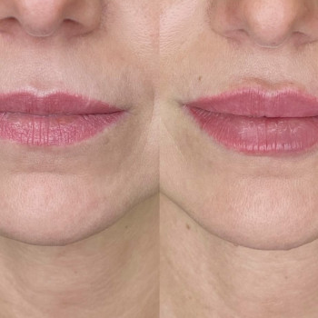 Контурная пластика губ, фото - мастер перманентного макияжа Інна Лебедь