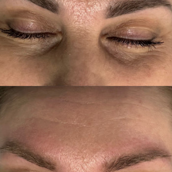 Видалення перманентну брів, фото - косметолог Ольга Мельник