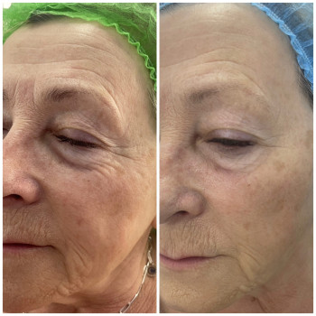 Фото з портфоліо косметолога Ольга Мельник (Біла Церква)