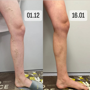 Тарас Вихтюк, Львов Фото - 5