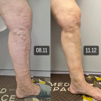 Тарас Вихтюк, Львов Фото - 6