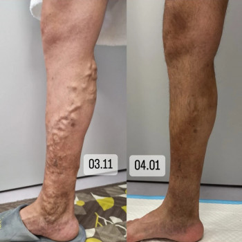 Тарас Вихтюк, Львов Фото - 7