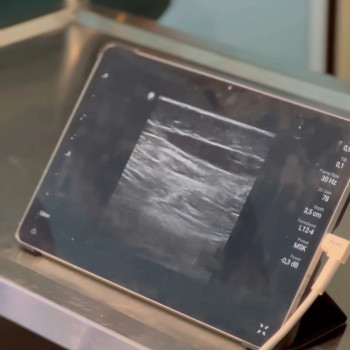 Андрей Мелень, Львов Фото - 5