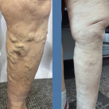 Дмитрий Залевский, Одесса Фото - 5