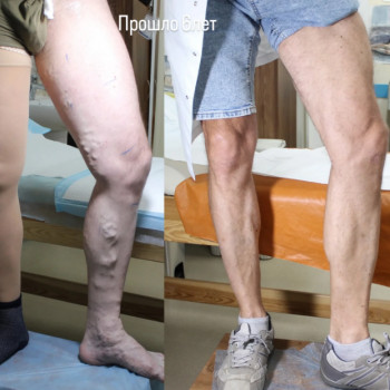 Александр Иванисов, Одесса Фото - 5