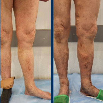 Дмитрий Рябущенко, Харьков Фото - 5