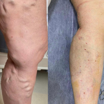 Денис Омеляненко, Полтава Фото - 5