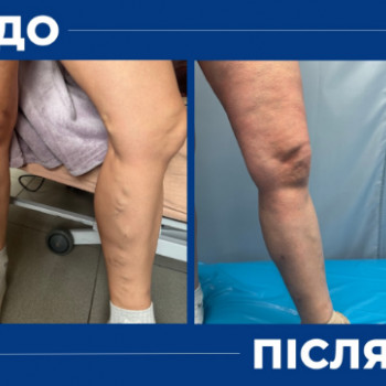 Денис Омеляненко, Полтава Фото - 6