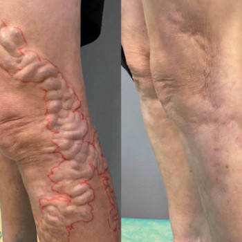 Вячеслав Рибачук, Чернигов Фото - 5