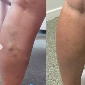 Юрий Свидерский, Тернополь Фото - 5