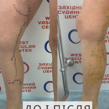 Фото из портфолио специалиста Юлия Моргун (флеболог, Хмельницкий)