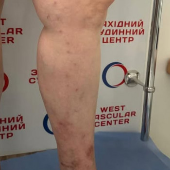 Фото из портфолио специалиста Юлия Моргун (флеболог, Хмельницкий)