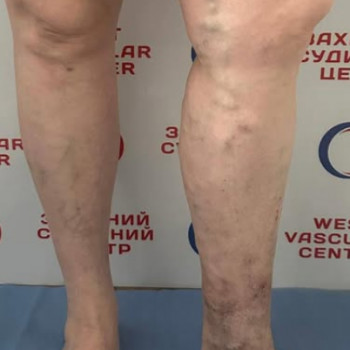 Фото из портфолио специалиста Юлия Моргун (флеболог, Хмельницкий)