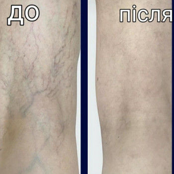 Фото из портфолио специалиста Валерий Гринчук (флеболог, Хмельницкий)