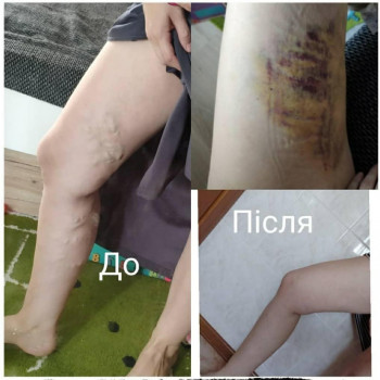 Фото из портфолио специалиста Валерий Гринчук (флеболог, Хмельницкий)
