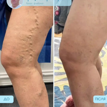 Фото из портфолио специалиста Валерий Гринчук (флеболог, Хмельницкий)