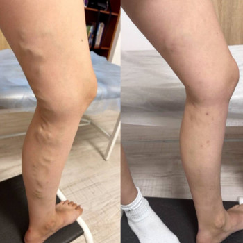 Юрий Фреишин, Ивано-Франковск Фото - 5