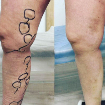 Юрий Фреишин, Ивано-Франковск Фото - 6