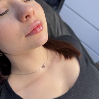 Фото из портфолио косметолога Любов Чумаченко (Запорожье)