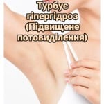 Ботокс від гіпергідрозу Косметолог Марина Чернигов