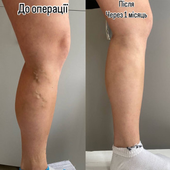 Иван Пасичник, Луцк Фото - 5