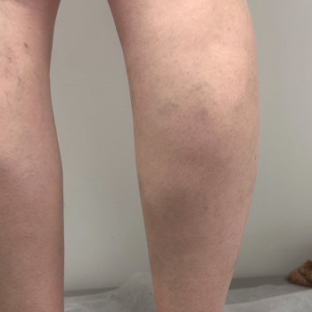 Анатолий Шитев, Ужгород Фото - 5