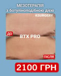 Ефект ботоксу без «застиглої» міміки: мезотерапія BTX PRO Косметологічний центр WE Cosmetology Київ